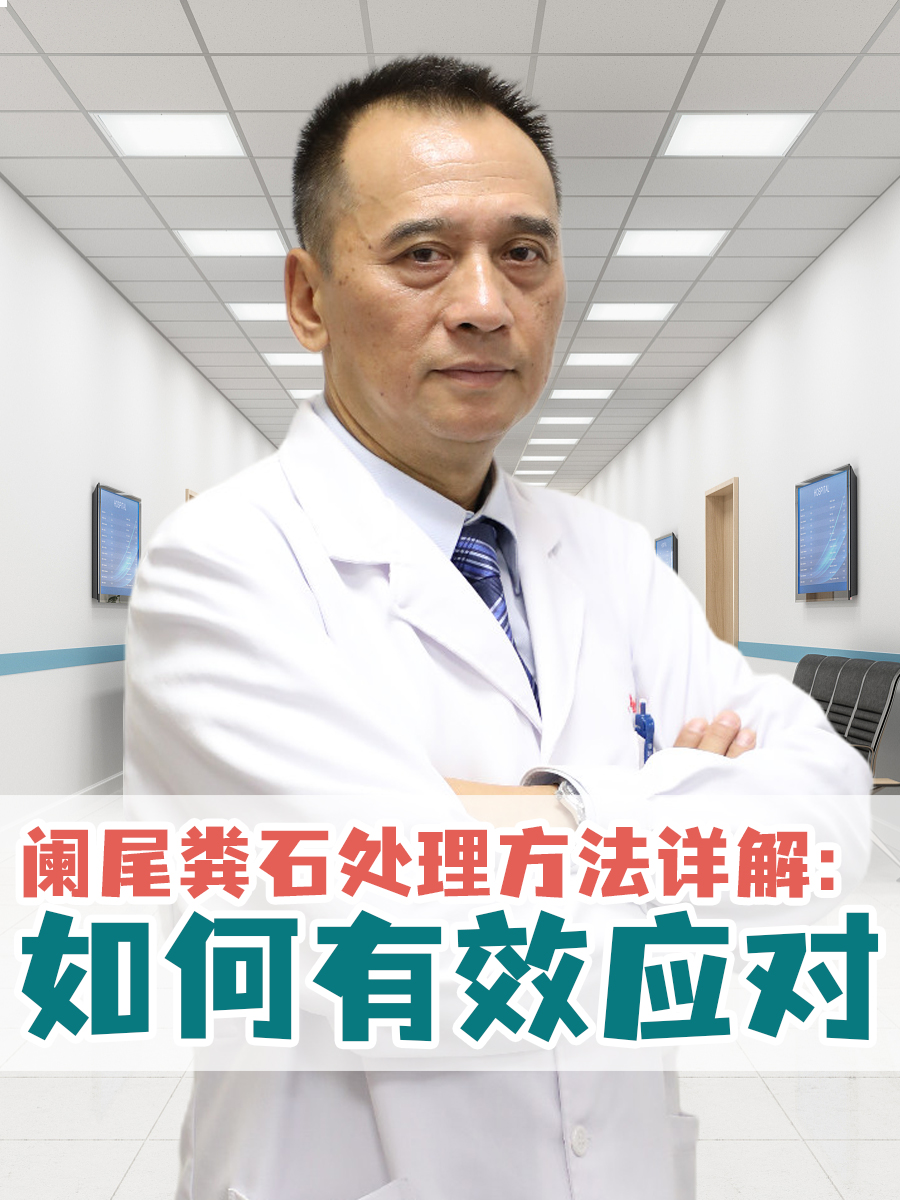 阑尾粪石处理方法详解:如何有效应对