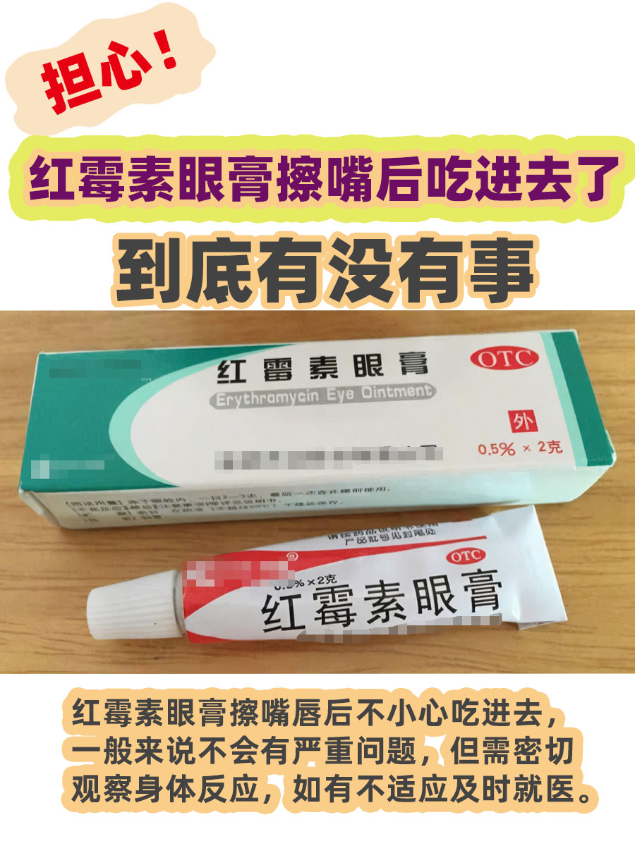 担心！红霉素眼膏擦嘴后吃进去了，到底有没有事