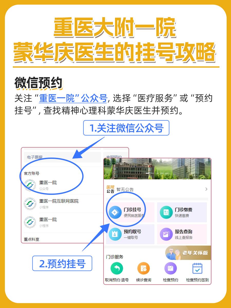 重庆医科大学附属第一医院蒙华庆医生怎么样?怎么挂号?