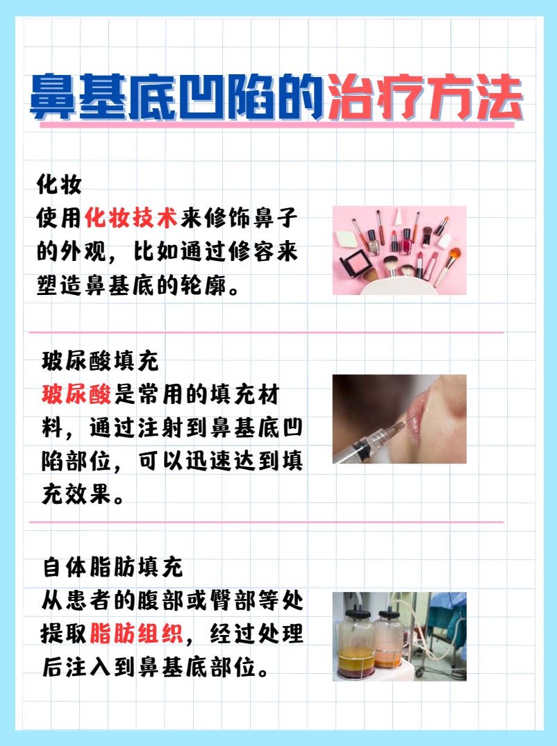 这篇文章带你了解，鼻基底凹陷是什么样子