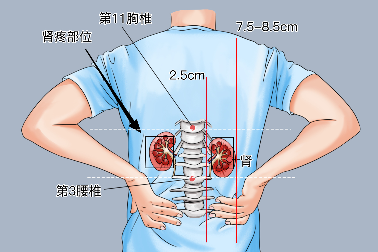 肾疼部位图