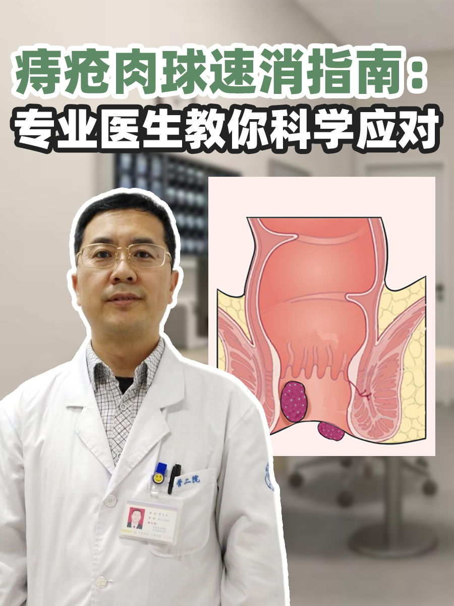 痔疮肉球速消指南:专业医生教你科学应对