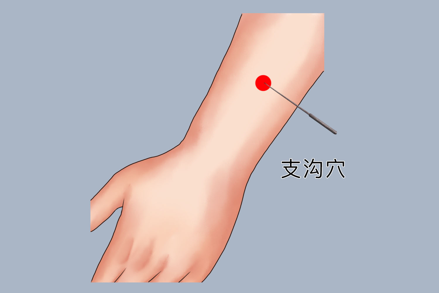 针灸支沟穴图