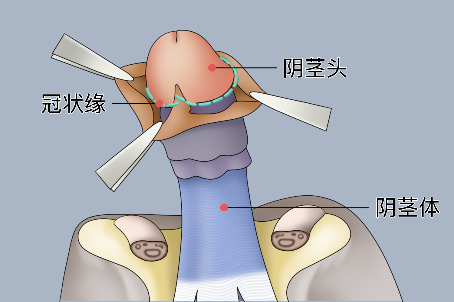 冠状缘位置图 冠状缘位置图