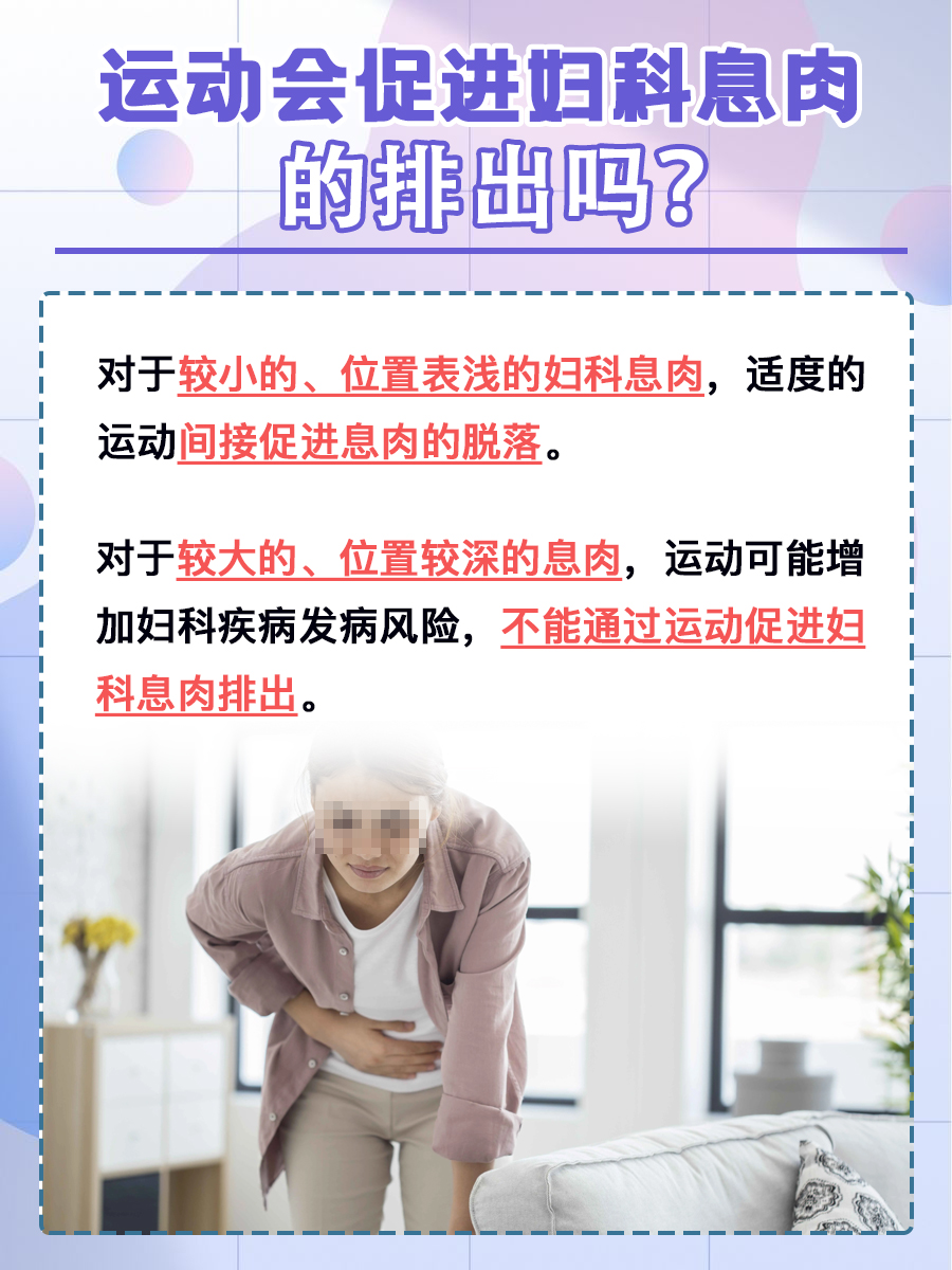医生解答:运动会促进妇科息肉的排出吗?