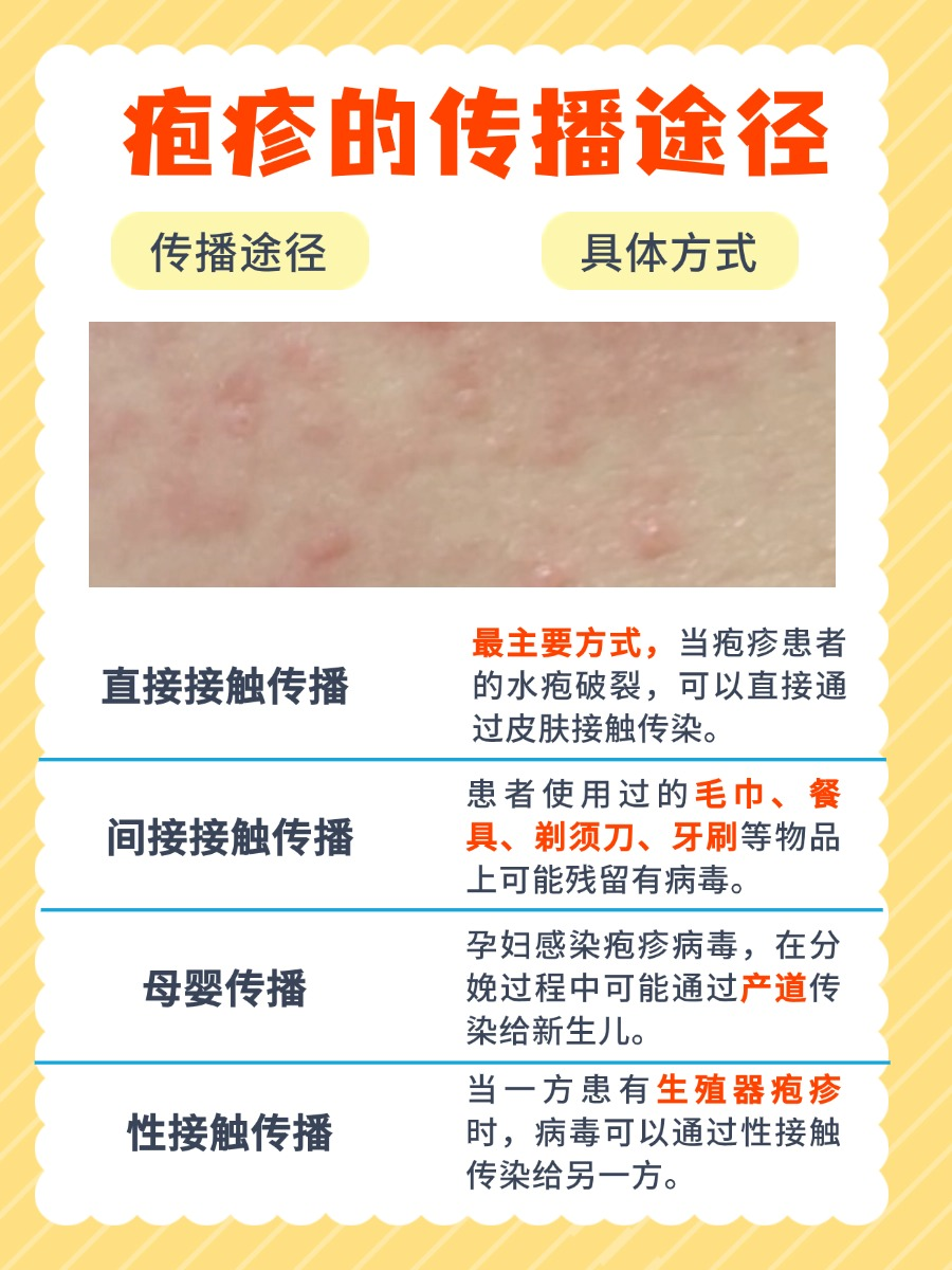 揭秘疱疹传播的途径:守护健康,从我做起!