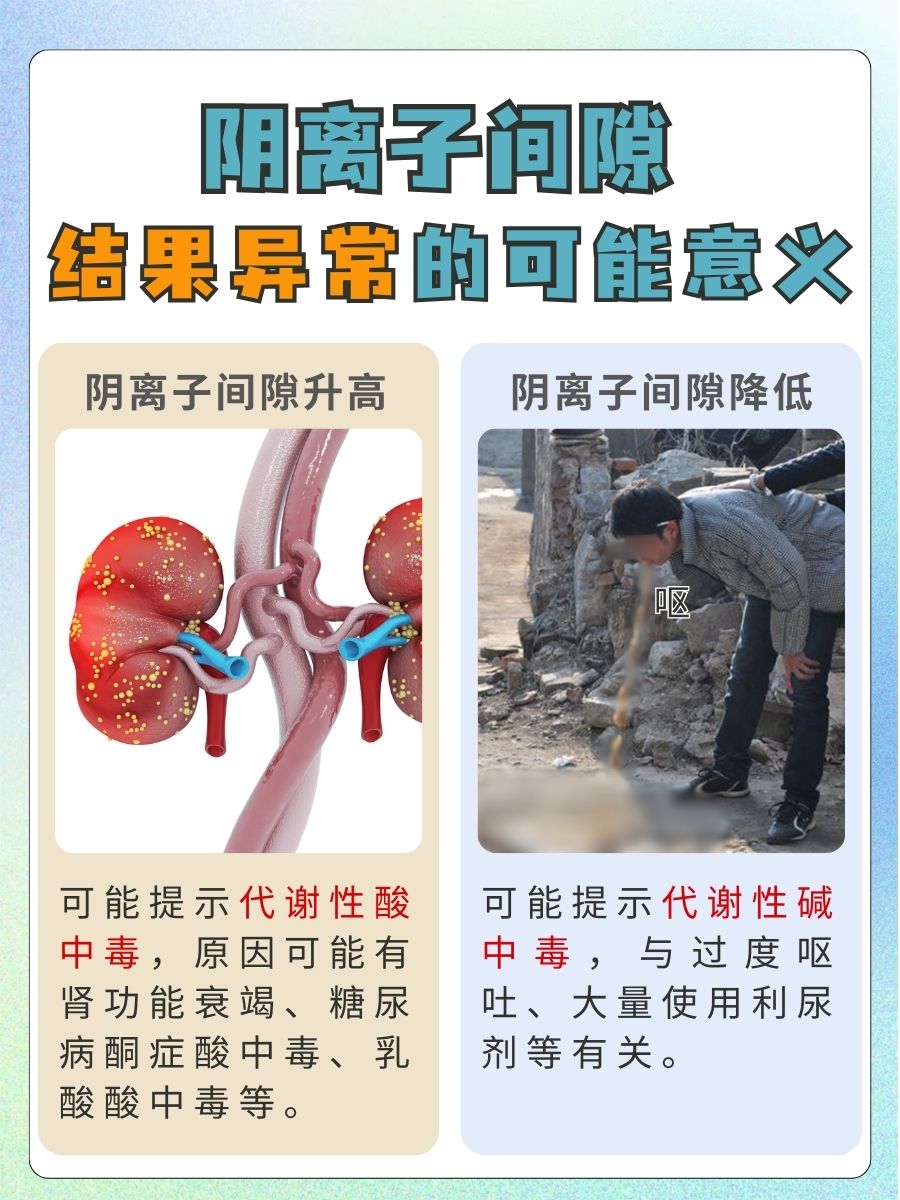 真相!阴离子间隙是什么?这些要点必须get!