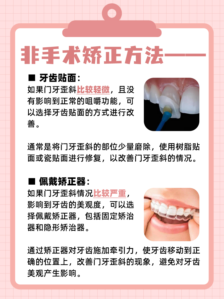 门牙歪斜影响美观，记得及时去矫正，别大意！