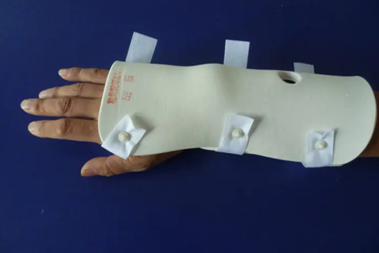 固定性腕关节支具图 固定性腕关节支具图