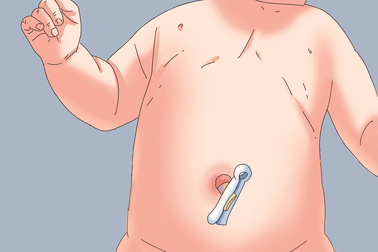 新生儿肚脐位置图