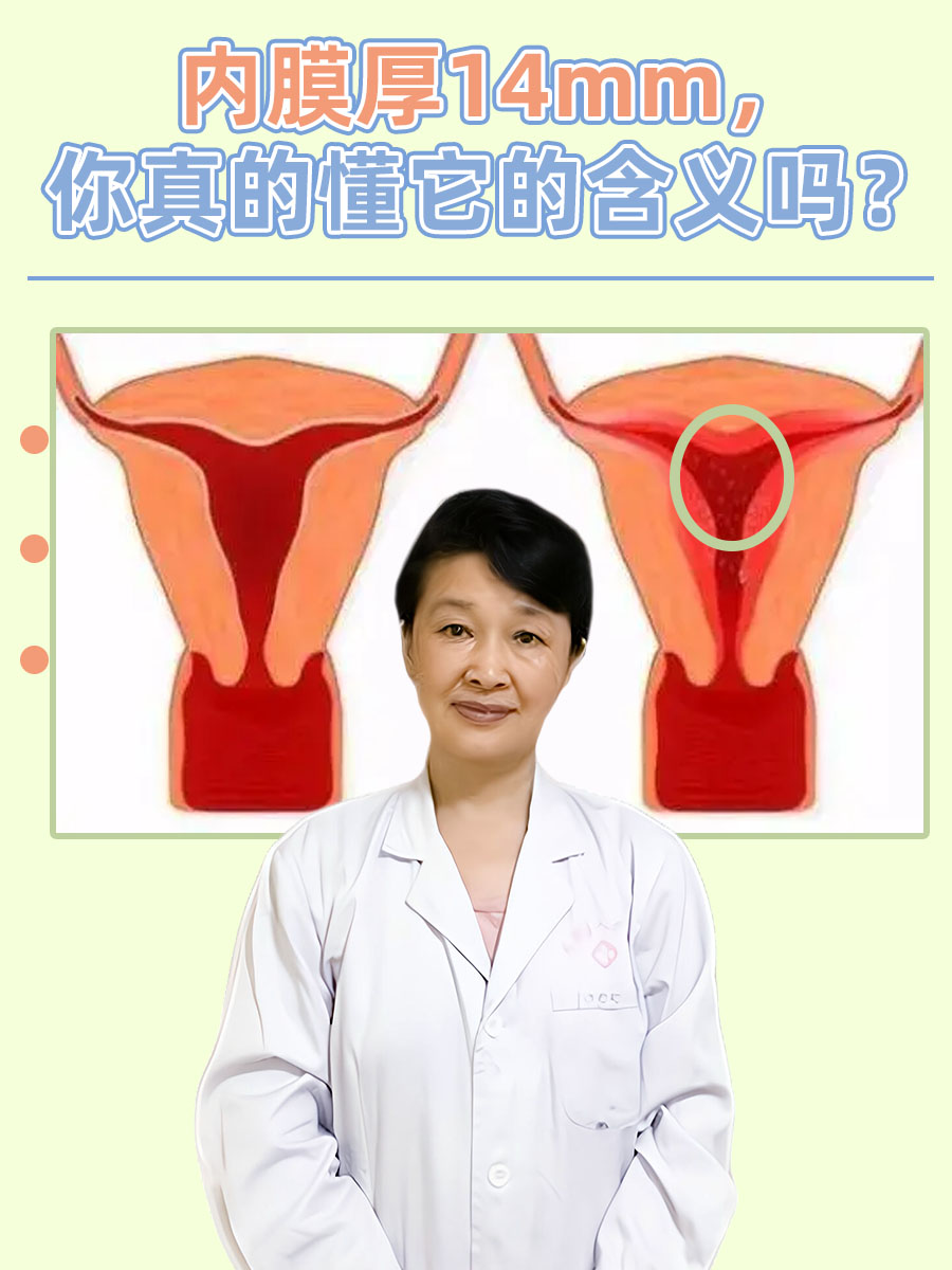 内膜厚14mm,你真的懂它的含义吗?