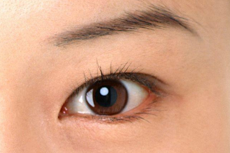 成人正常眼睑颜色图 成人正常眼睑颜色图