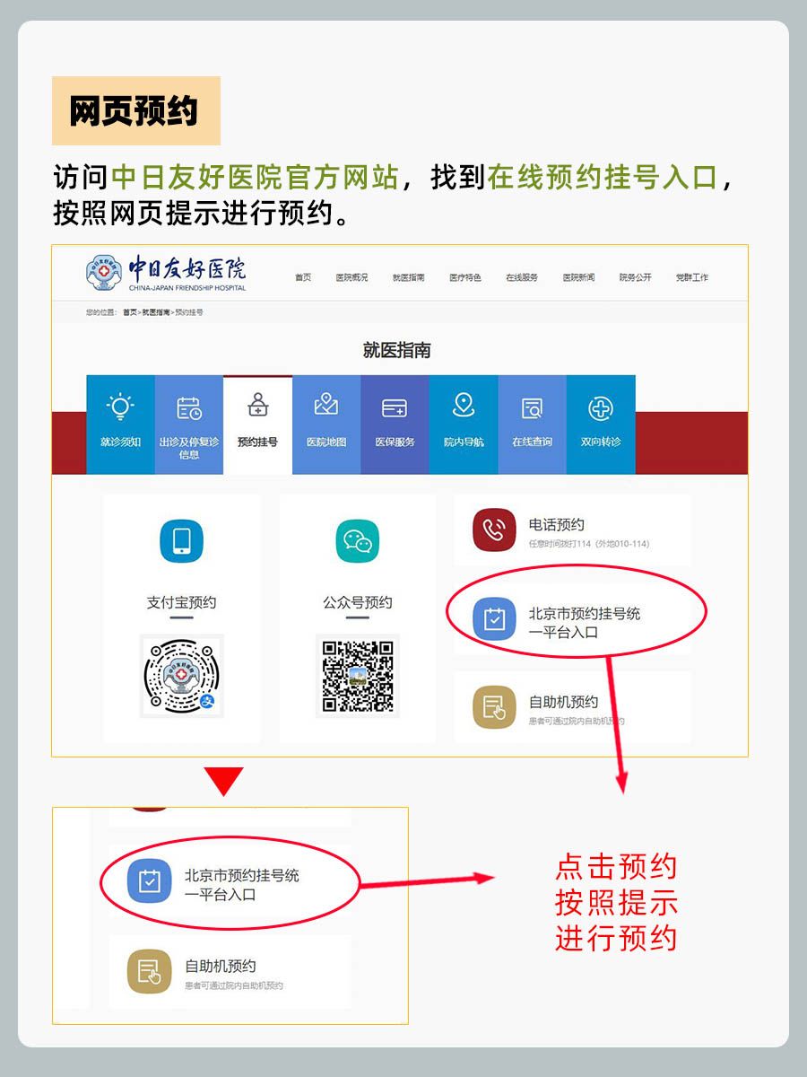 中日友好医院张丽雯医生怎么样？怎么挂号？