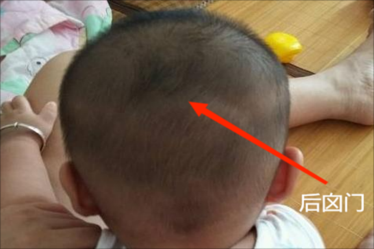 后囟门微微凹陷图 后囟门微微凹陷图