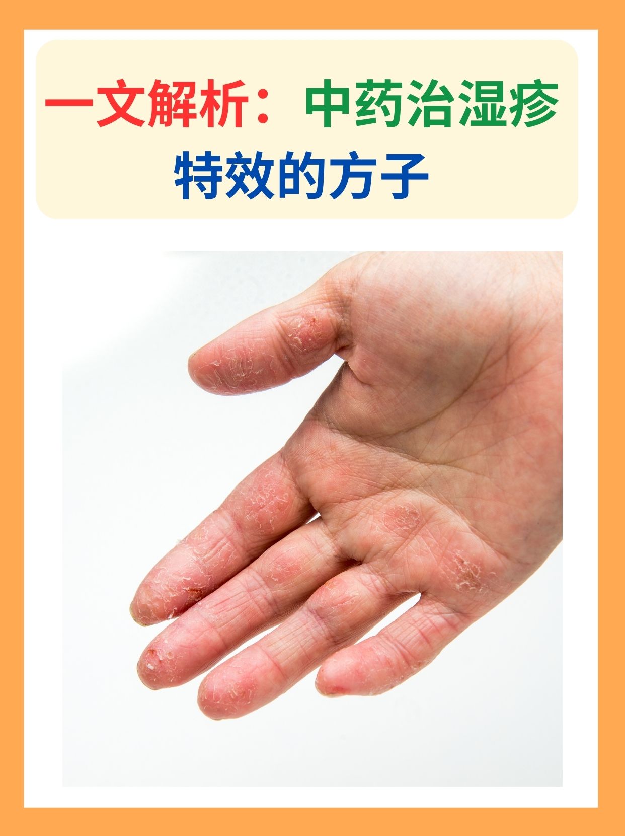 一文解析：中药治湿疹特效的方子