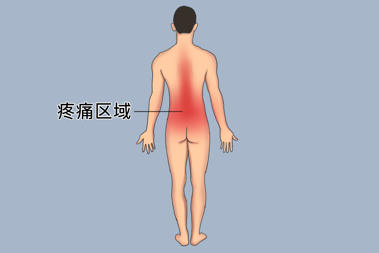 脊柱骨质疏松疼痛位置图
