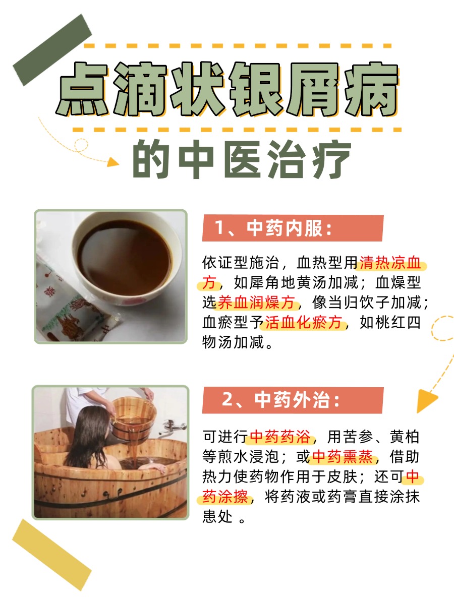 点滴状银屑病到底是啥？真能被治愈吗？