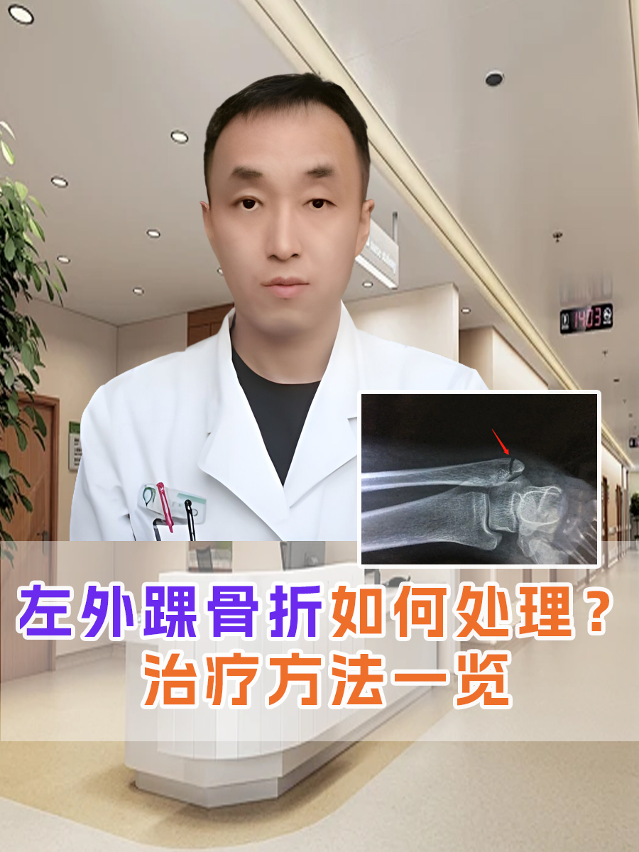 左外踝骨折如何处理？治疗方法一览