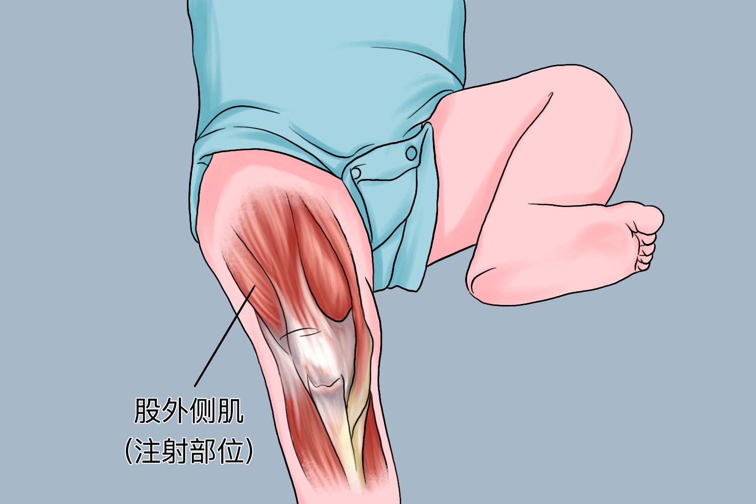 股外侧肌肌肉注射定位图