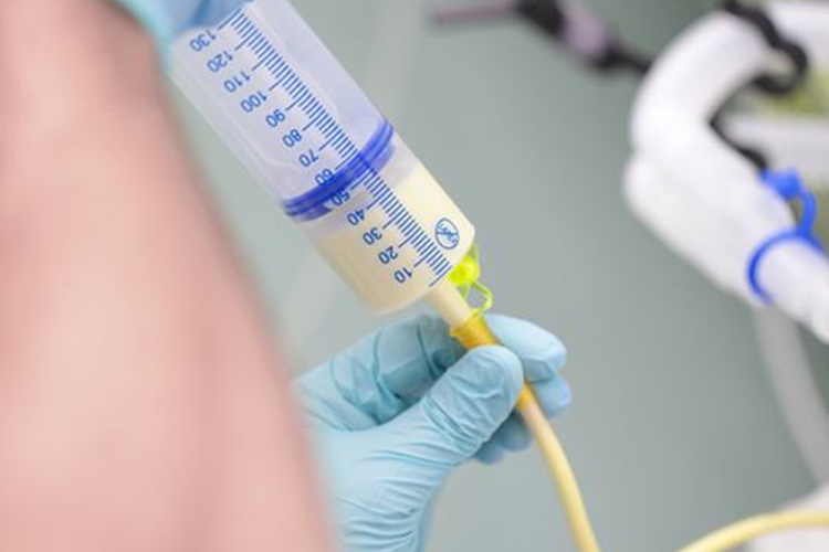 鼻饲灌注流食图