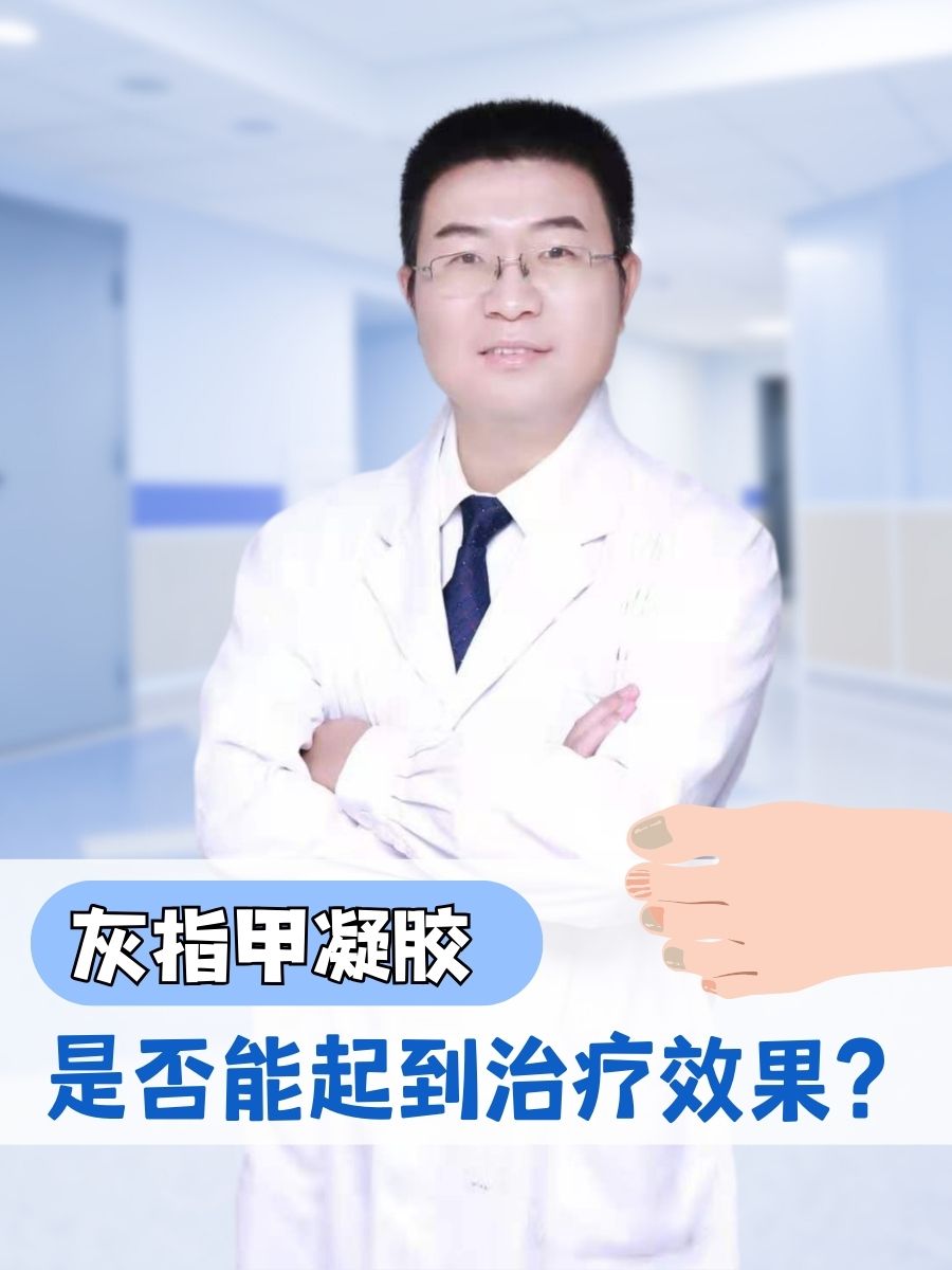 灰指甲凝胶——是否能起到治疗效果?