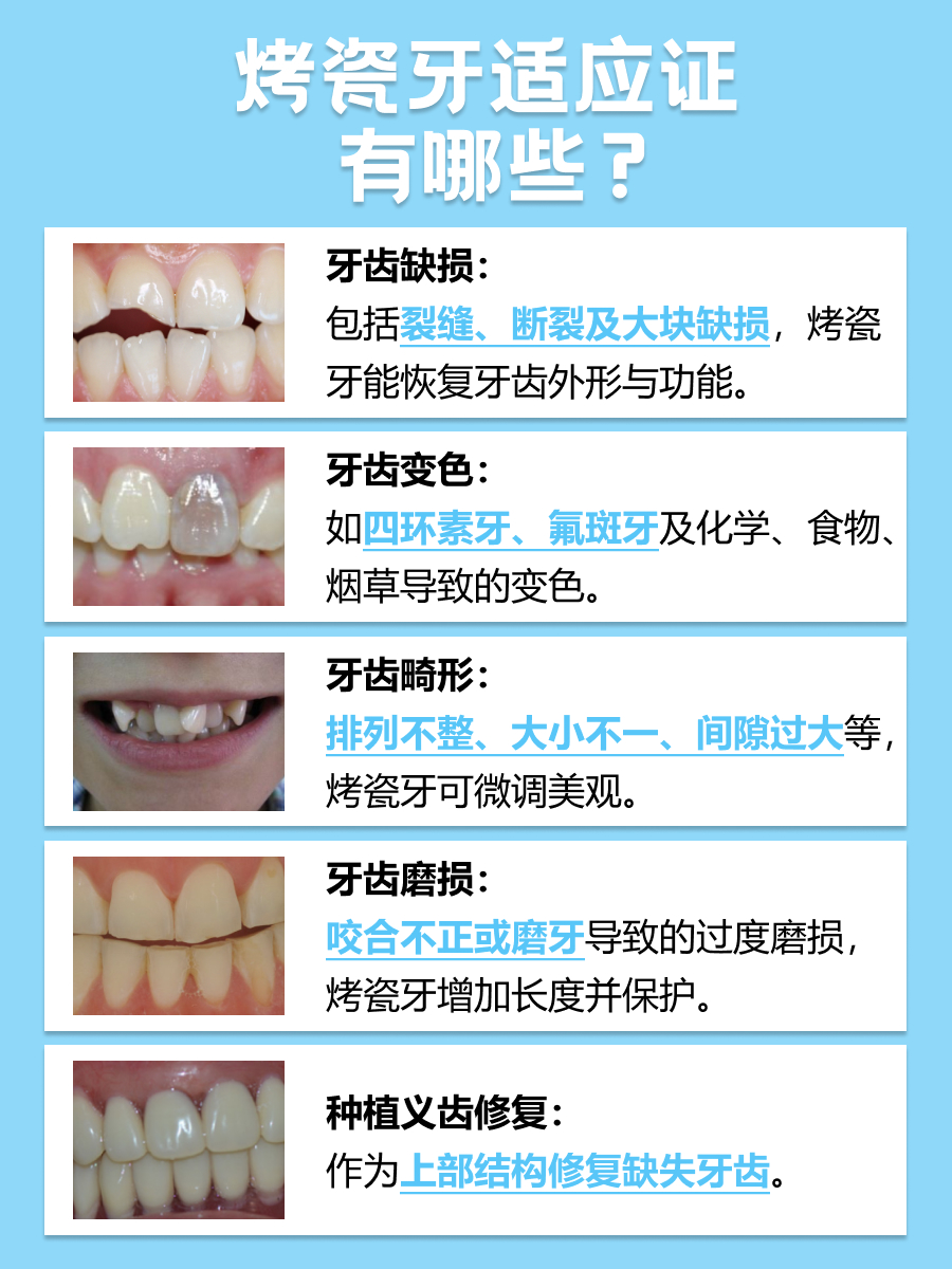 医生解答烤瓷牙的价格一般是多少，让你心中有数！