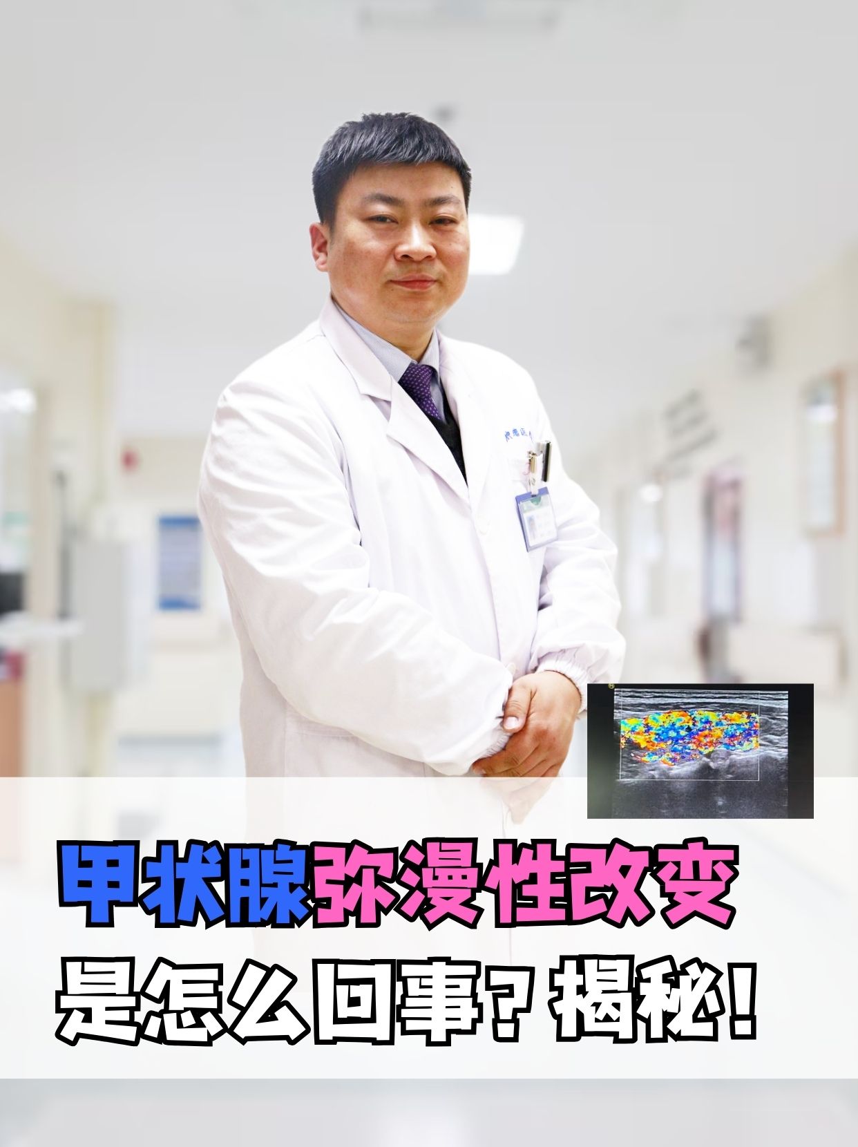 甲状腺弥漫性改变是怎么回事?揭秘!
