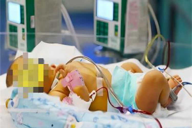 胆汁淤积性黄疸全身皮肤发黄图 胆汁淤积性黄疸全身皮肤发黄图