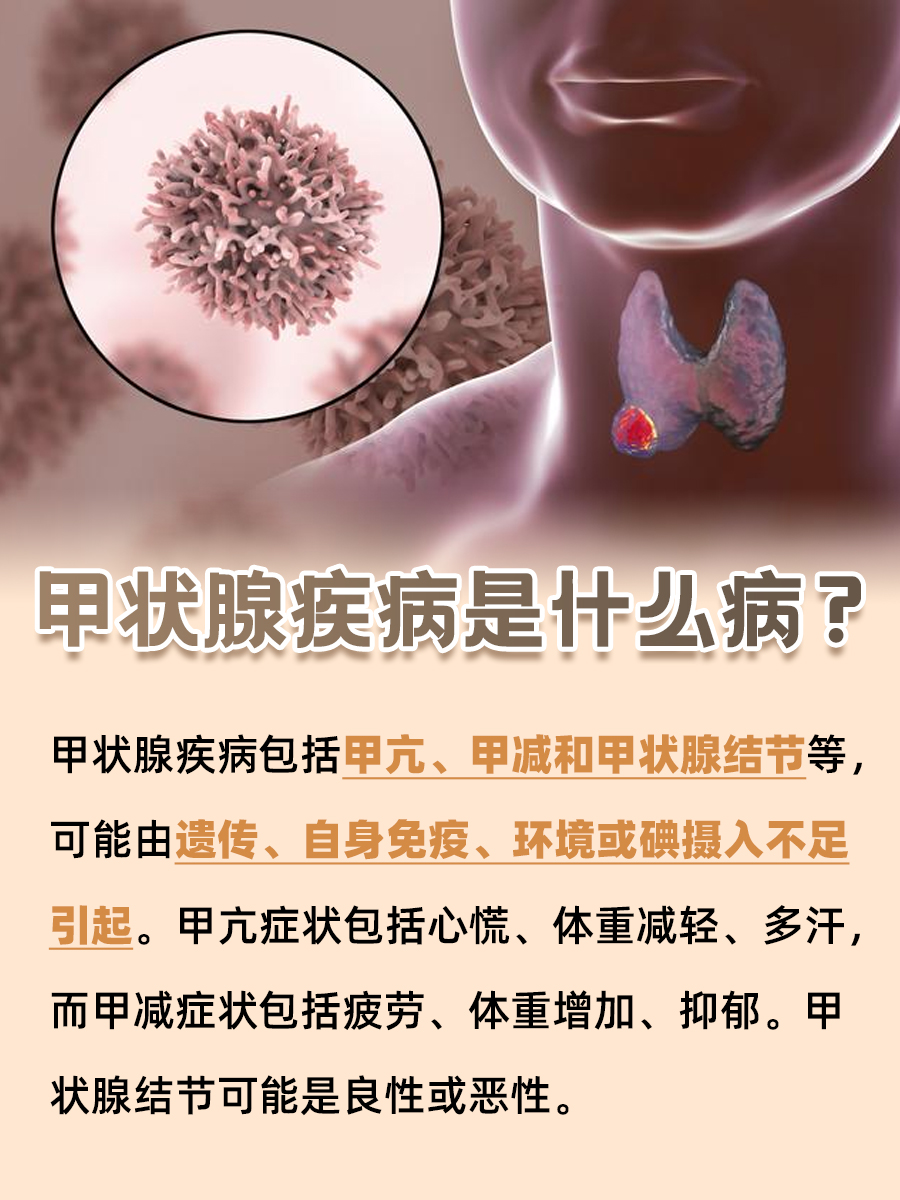 一文了解：甲状腺疾病是什么病