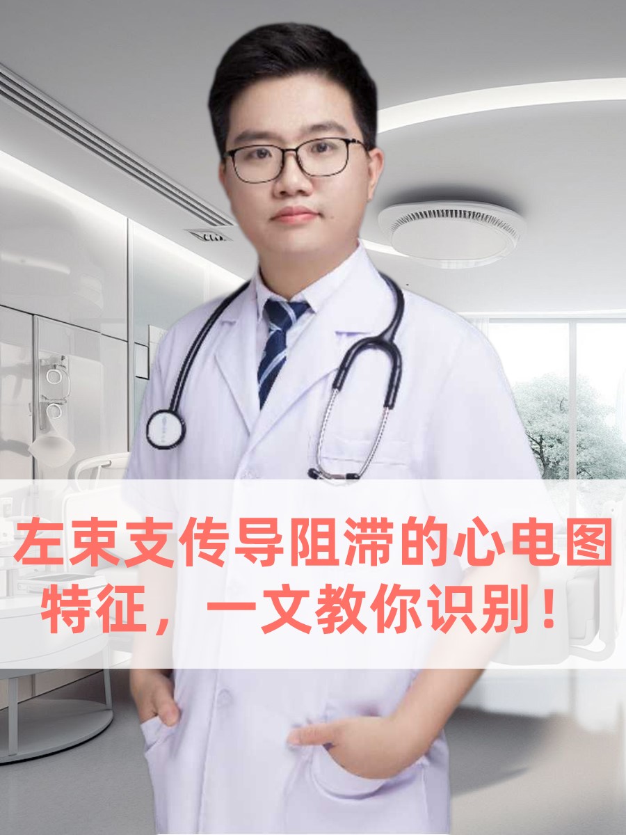 左束支传导阻滞的心电图特征，一文教你识别！