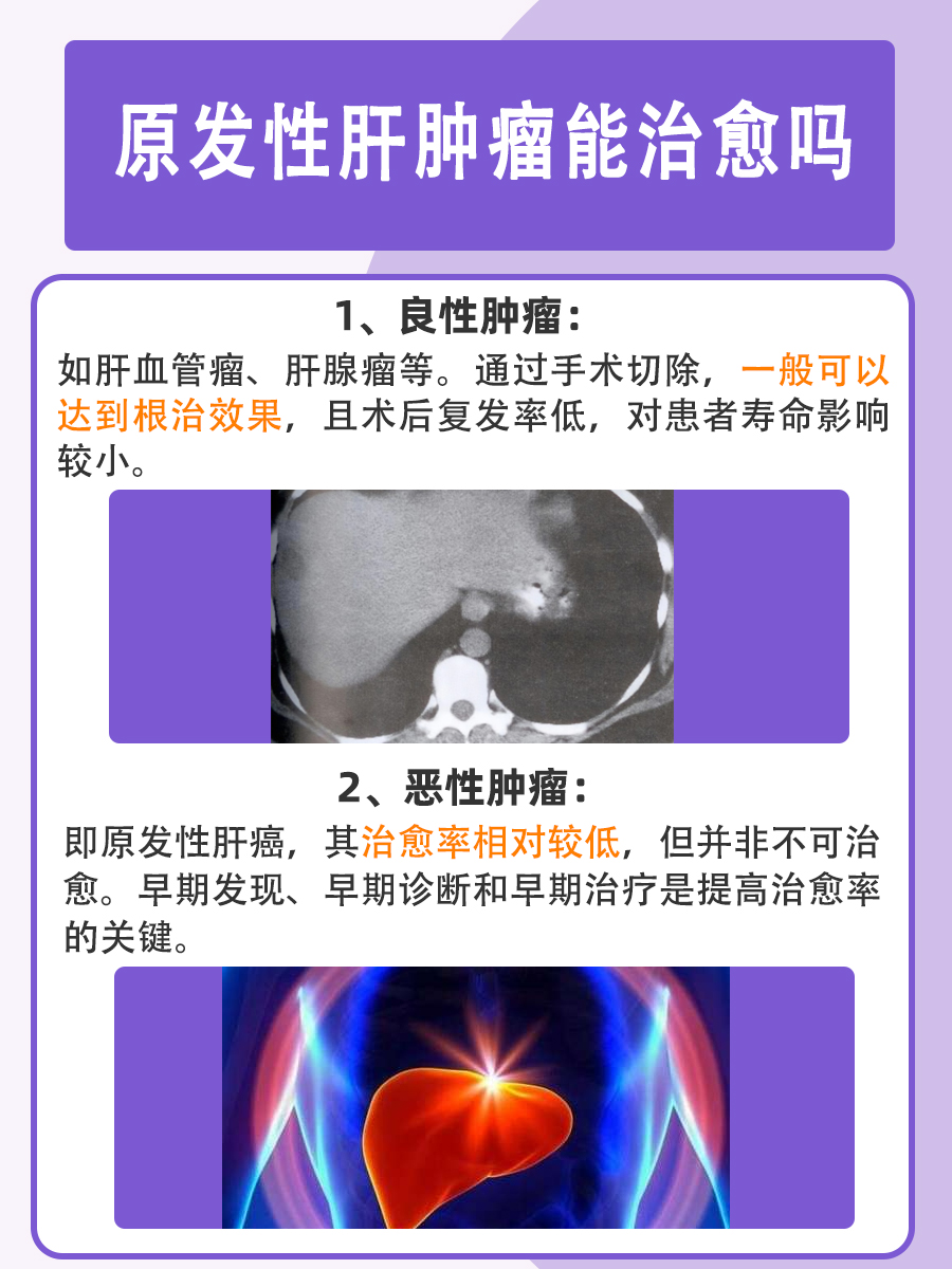 原发性肝肿瘤能否治愈？专家为您解答