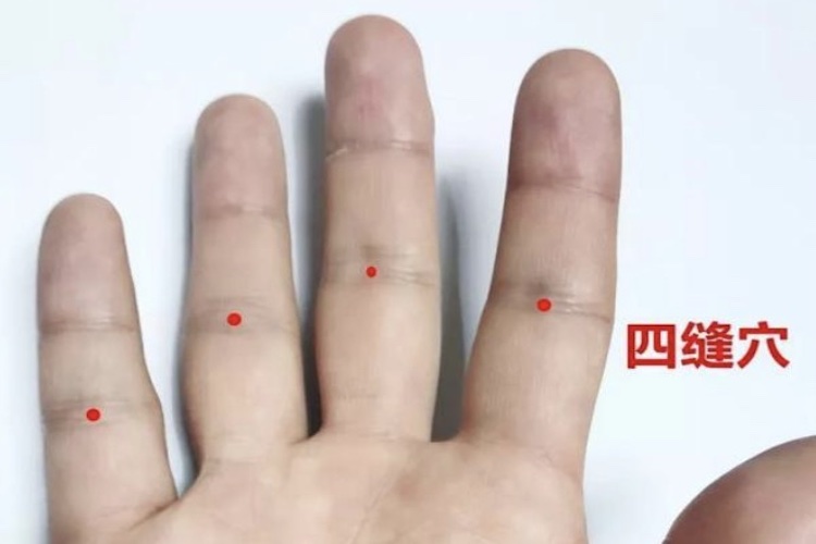 四缝穴位置图 四缝穴位置图