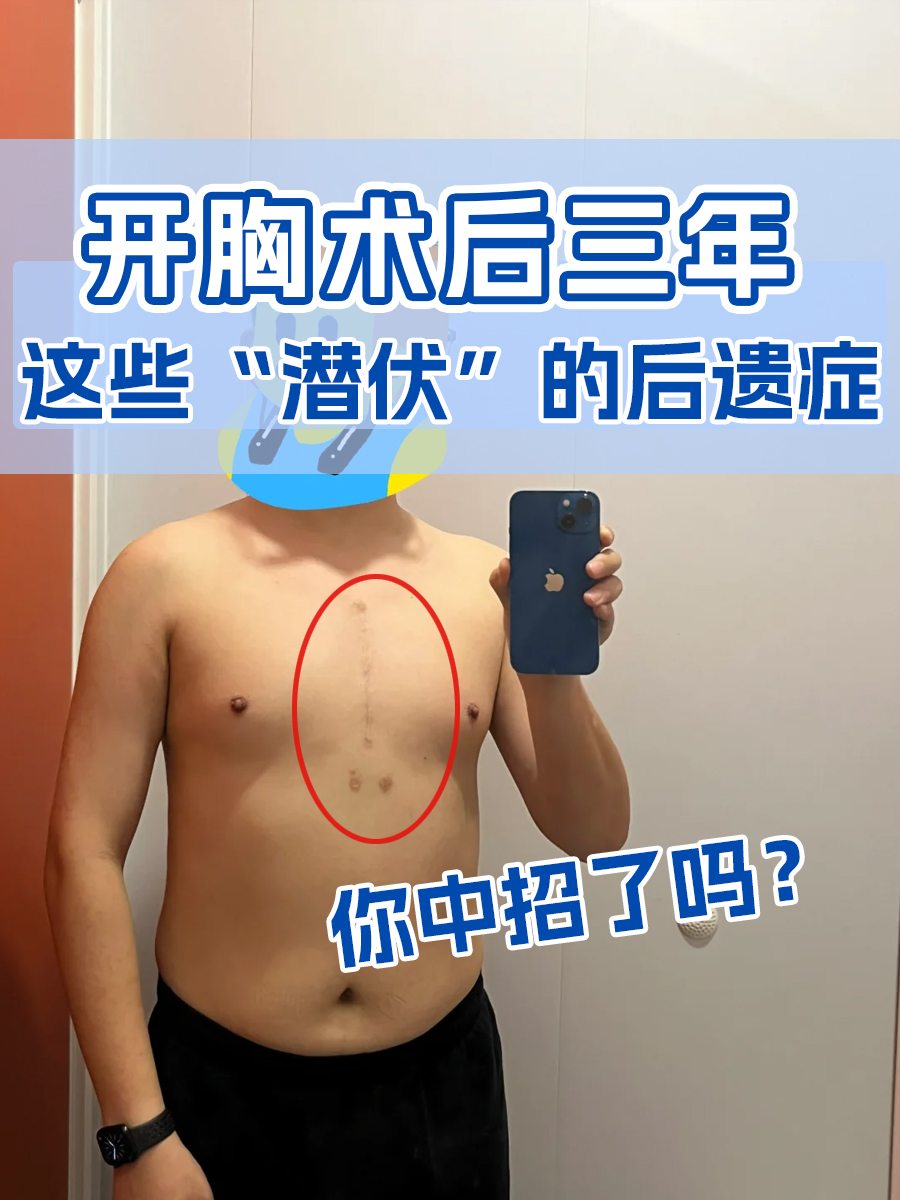 开胸术后三年，这些“潜伏”的后遗症你中招了吗