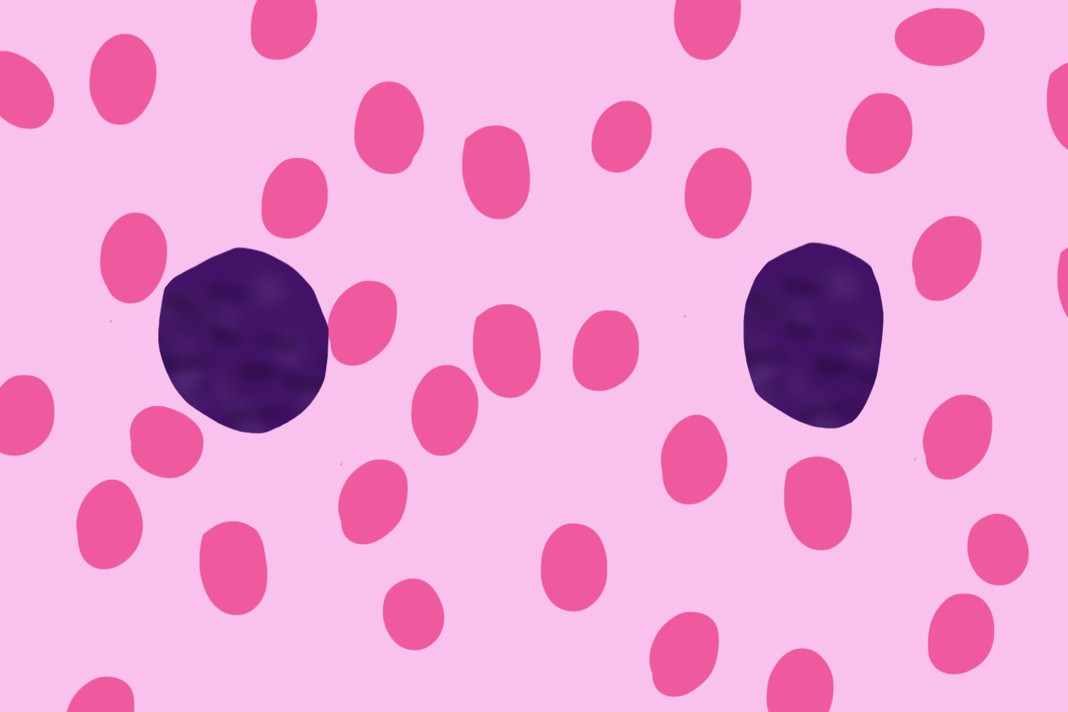 Ⅲ型异型淋巴细胞图