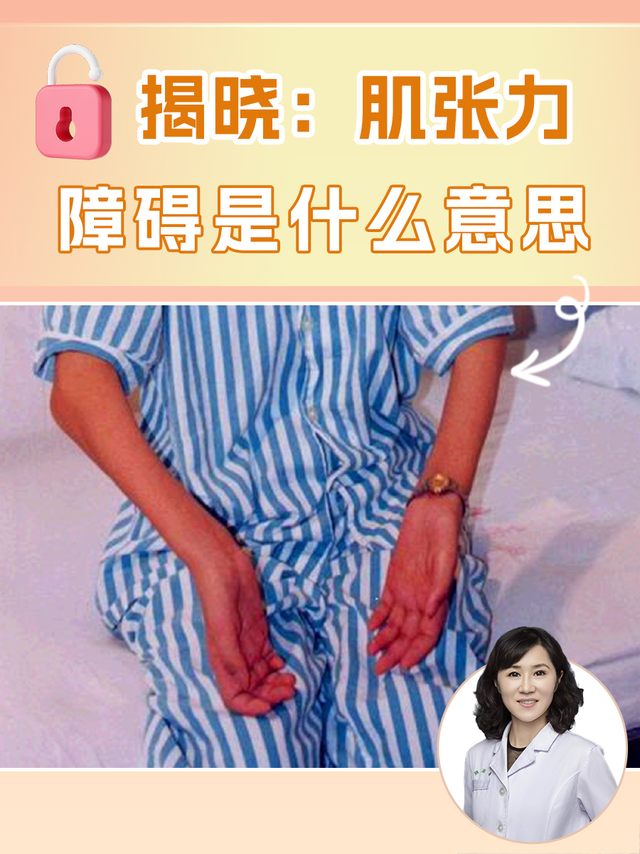 揭晓：肌张力障碍是什么意思