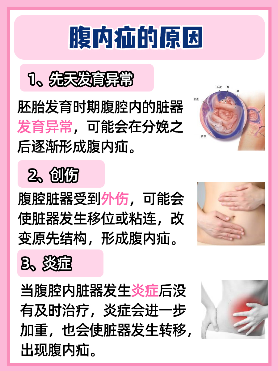 腹内疝揭秘：藏在肚子里的“秘密通道”