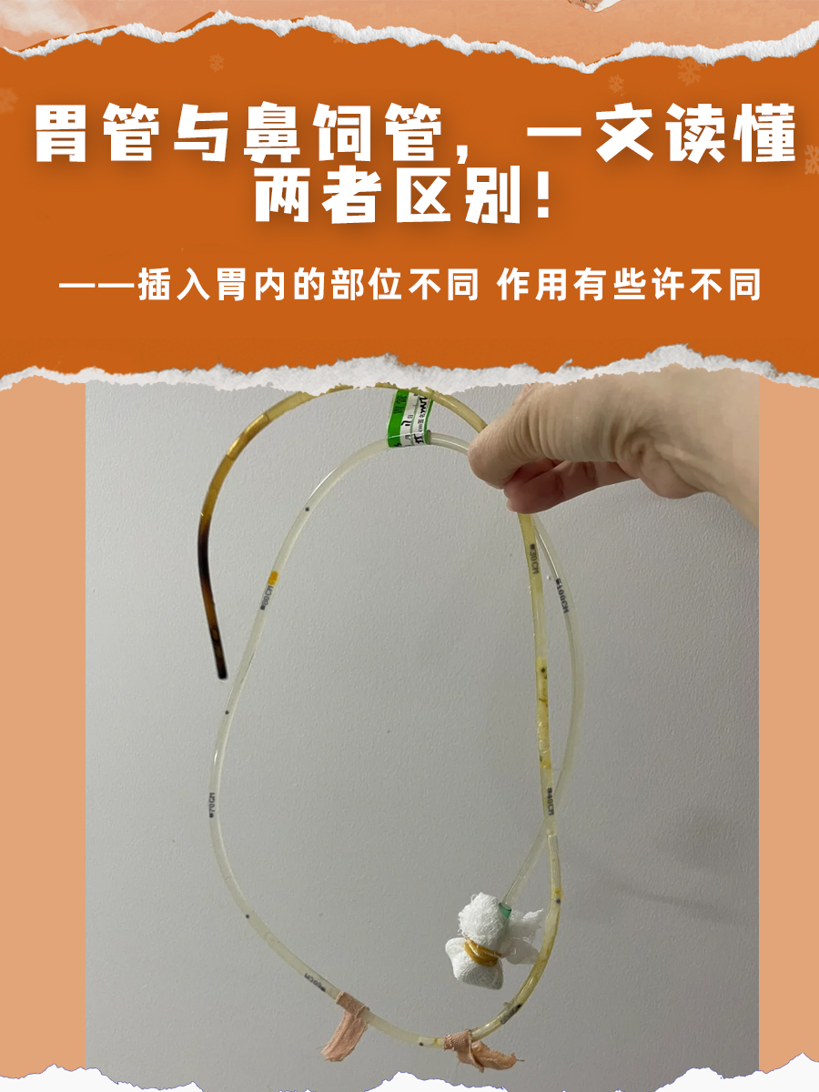 胃管与鼻饲管，一文读懂两者区别！
