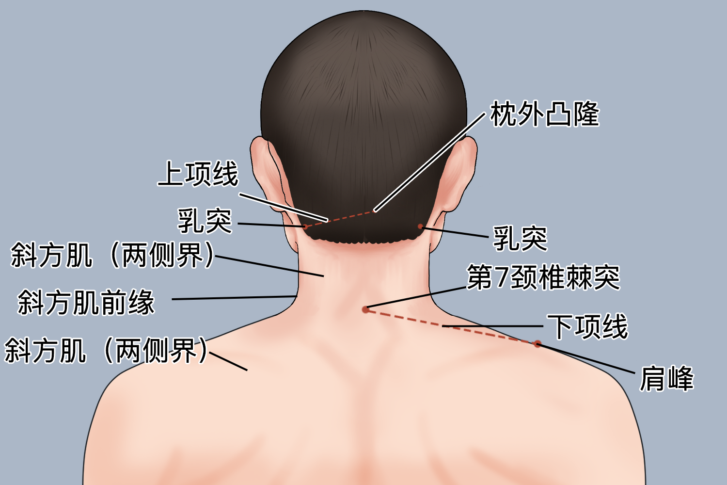 颈部斜方肌位置图图片