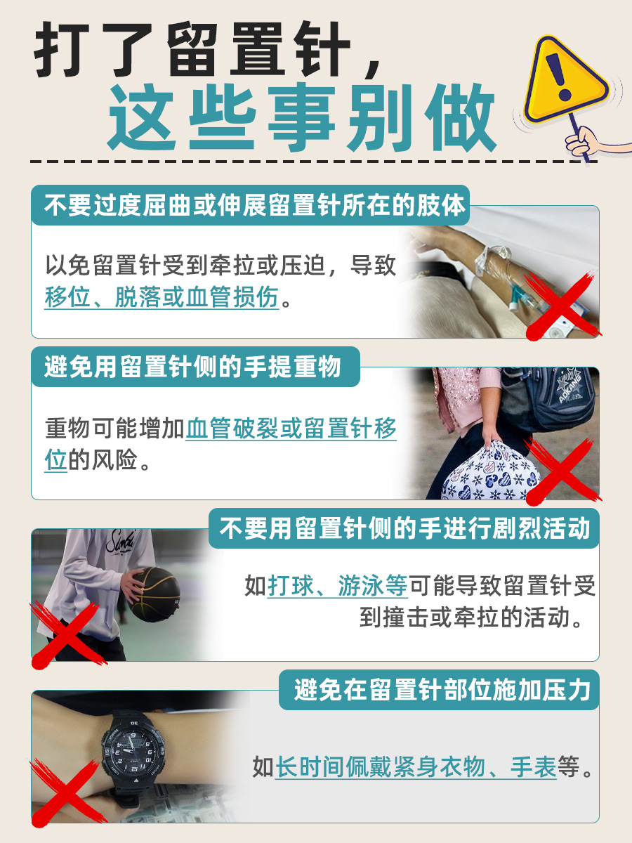 留置针使用期限：究竟能挺多久？