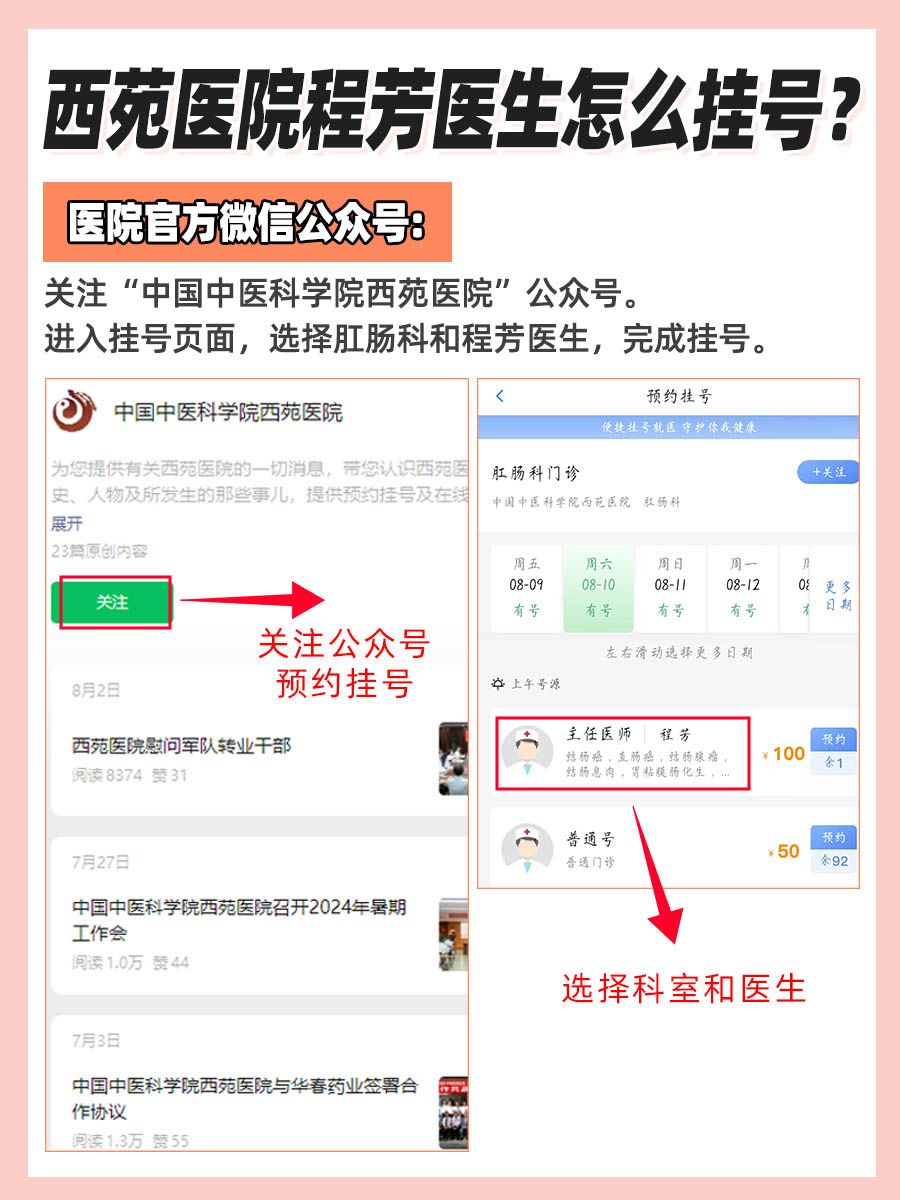 西苑医院程芳医生怎么样？怎么挂号？