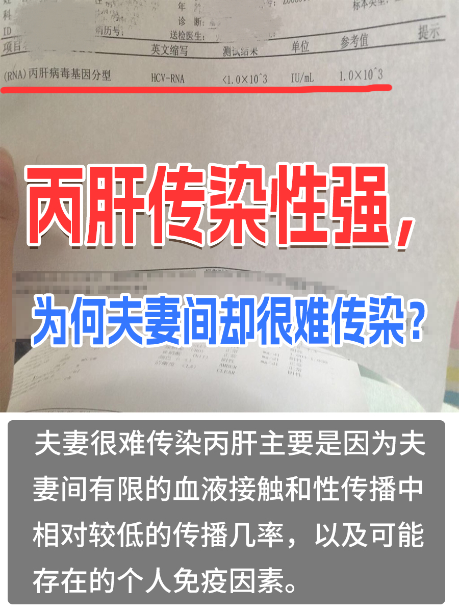 丙肝传染性强,为何夫妻间却很难传染?