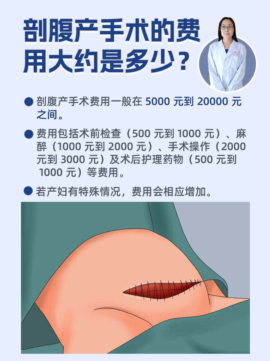 剖腹产手术的费用大约是多少?