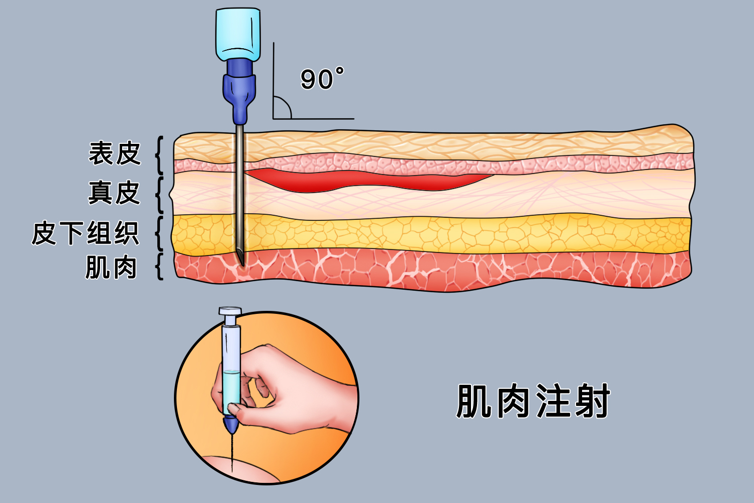 好看的肌注打针图片