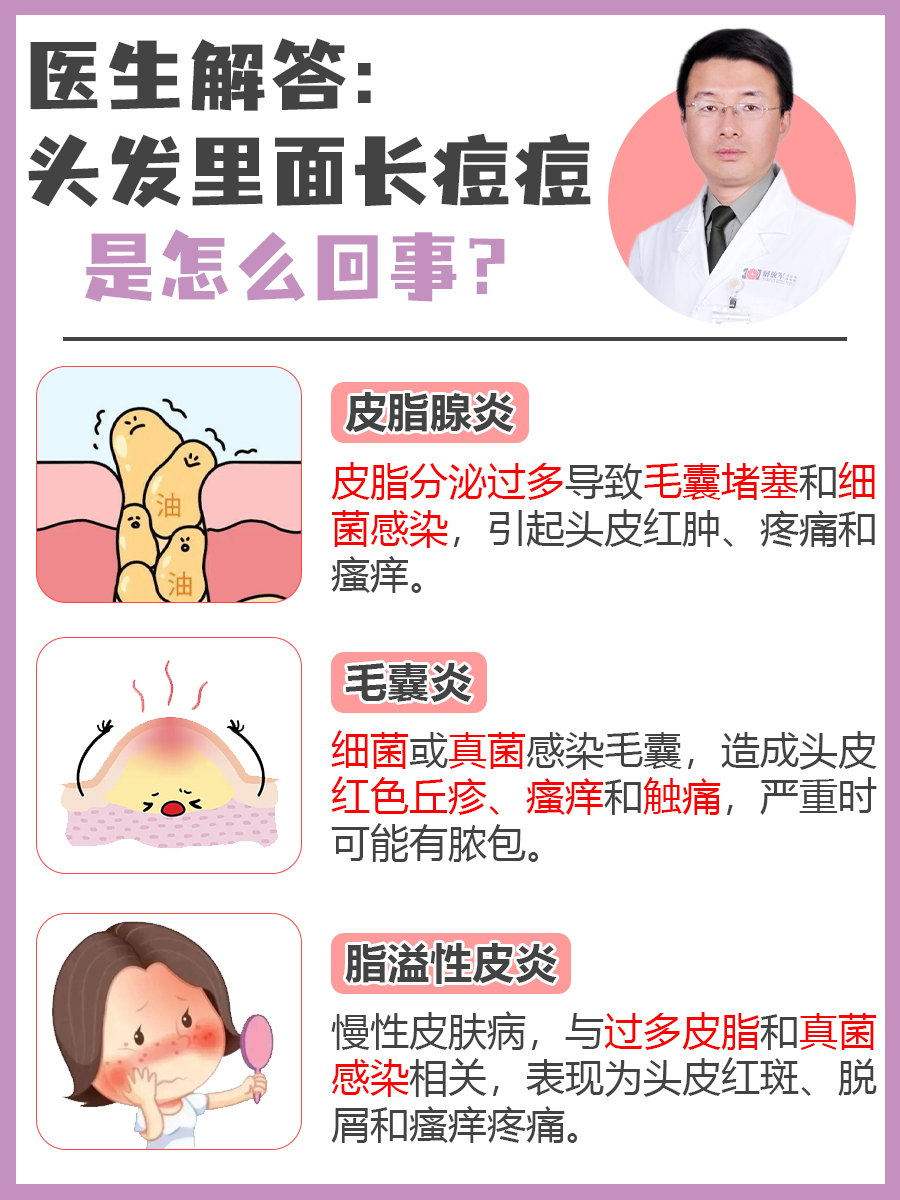 医生解答：头发里面长痘痘是怎么回事？