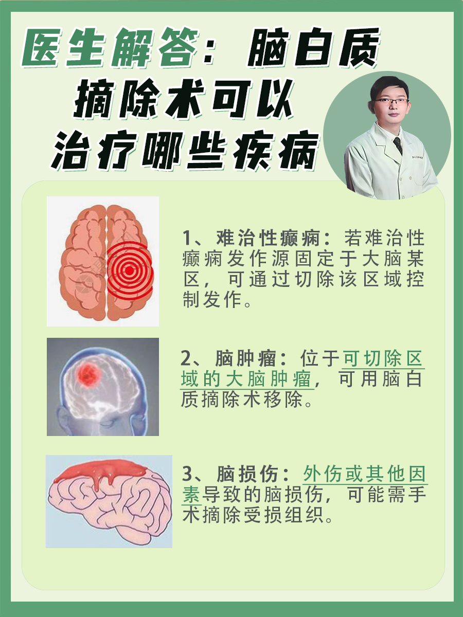 医生解答：脑白质摘除术可以治疗哪些疾病