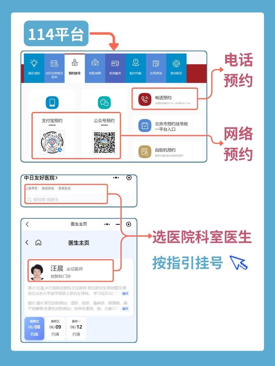 中日友好医院汪晨医生怎么样？怎么挂号？