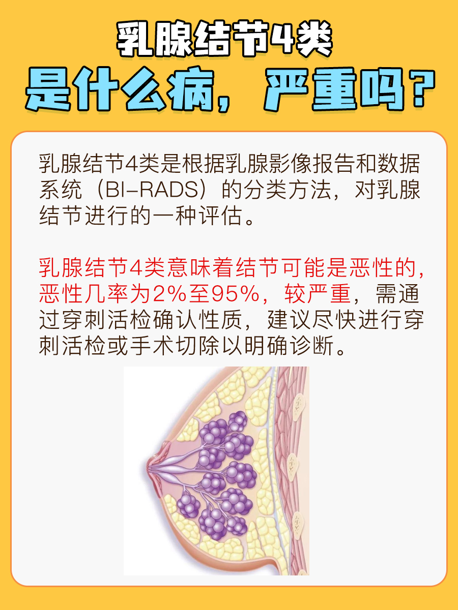 乳腺结节4类，疾病严重性解析！