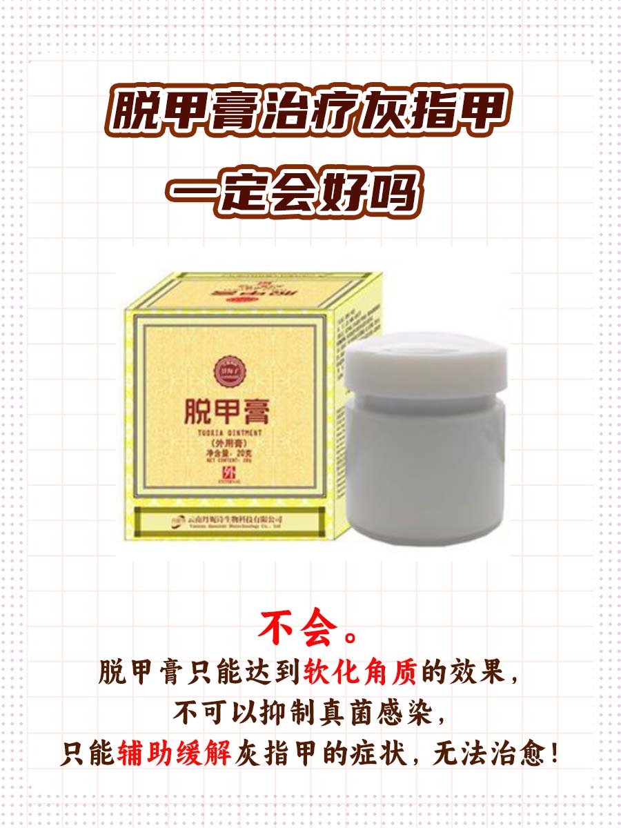 大揭秘：脱甲膏治疗灰指甲一定会好吗？