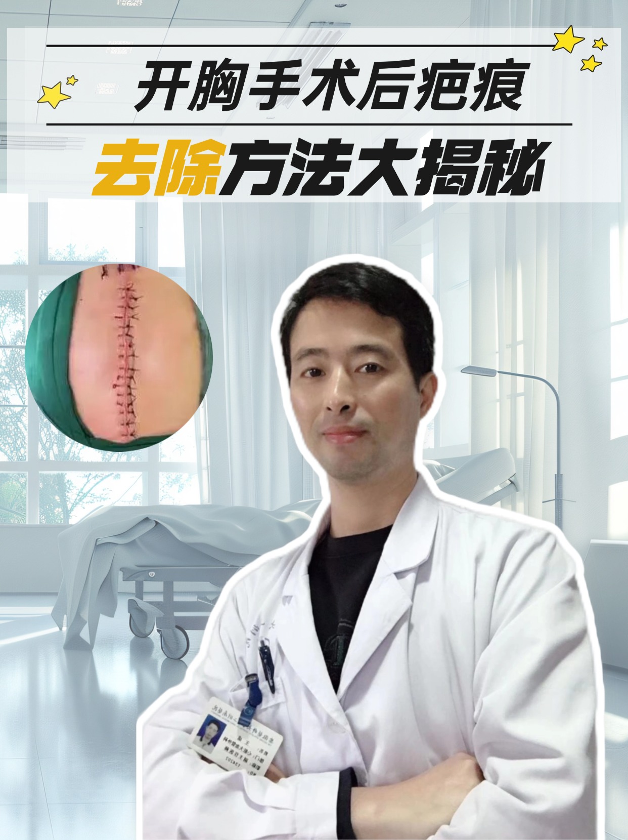 开胸手术后疤痕，去除方法大揭秘