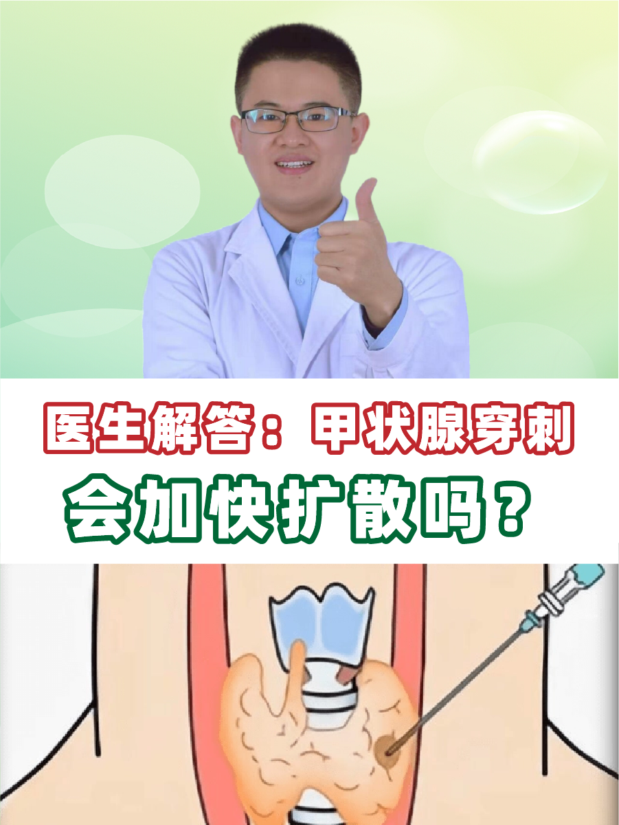 医生解答：甲状腺穿刺会加快扩散吗？